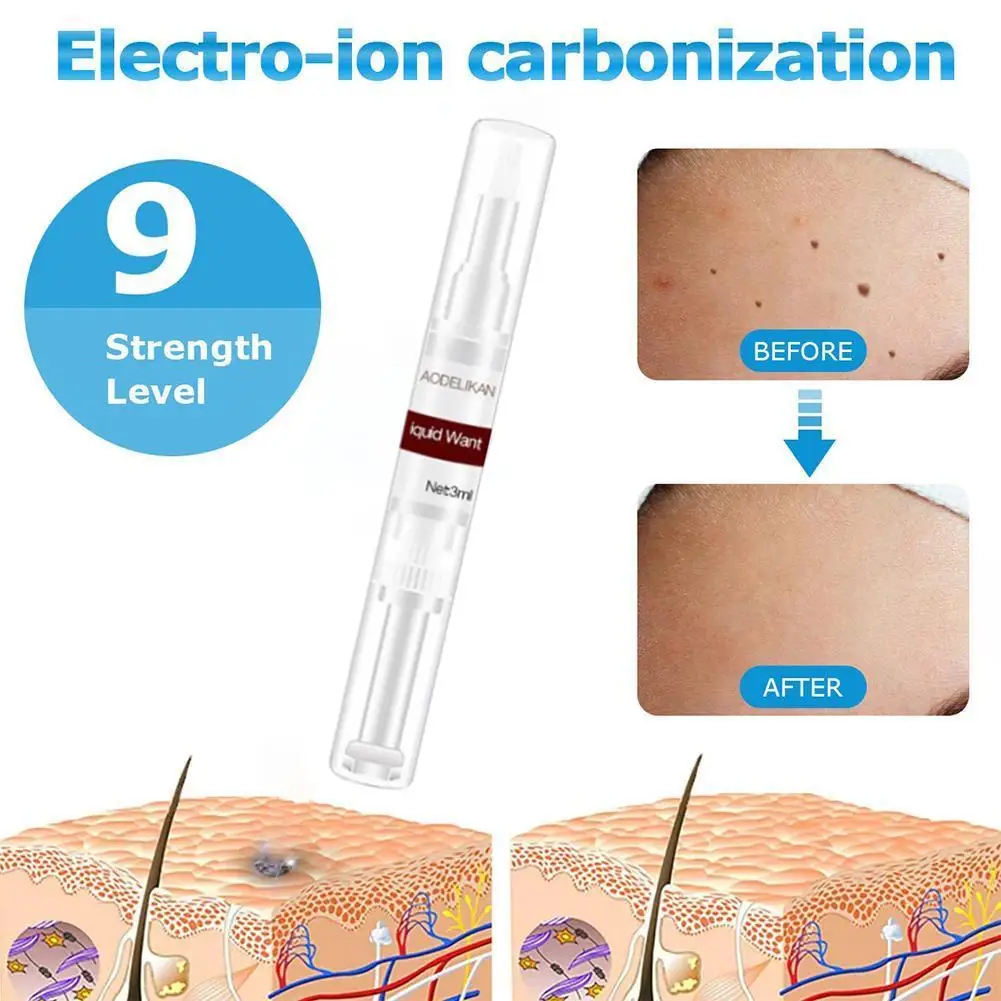 Gram Wart Liquid Pen 3ml Ordinary Warts Flat Warts Warts Condyloma Remove Filamentous Warts To Thorns To Warts Warts Sharp D4C6
Gram Wart Liquid Pen 3ml Ordinary Warts Flat Warts Warts Condyloma Remove Filamentous Warts To Thorns To Warts Warts Sharp D4C6