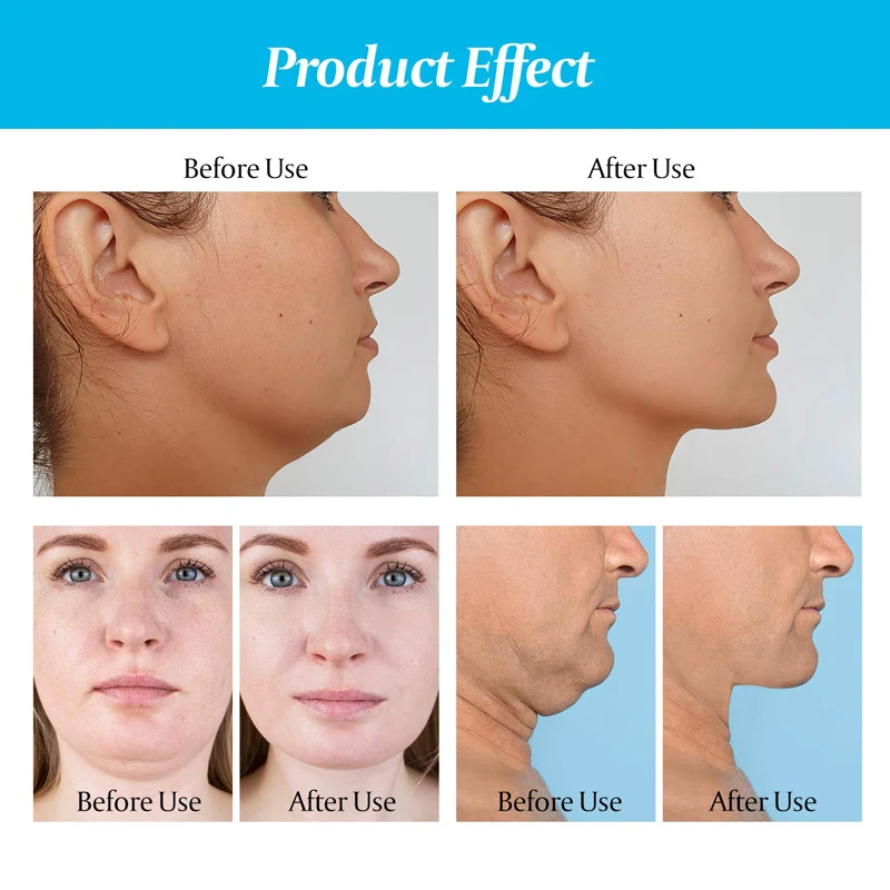 Generic Jaw Exercise Ball Pop N Go Mouth Jawline Exerciser Food Grade