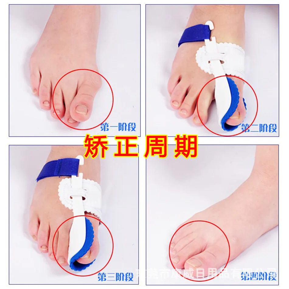 Hallux Valgus Corrector Day And Night Use Silicone Toe Sleeve Toe Separation Toe Separator fen zhi qi Orthopedic Insole
Hallux Valgus Corrector Day And Night Use Silicone Toe Sleeve Toe Separation Toe Separator fen zhi qi Orthopedic Insole