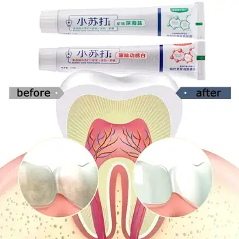 1pc Random One Soda Toothpaste Refreshing Mint Fragrance Removal Oral Care Freshen Toothpaste Whitening Stain Toothpaste Br J3H7
1pc Random One Soda Toothpaste Refreshing Mint Fragrance Removal Oral Care Freshen Toothpaste Whitening Stain Toothpaste Br J3H7
