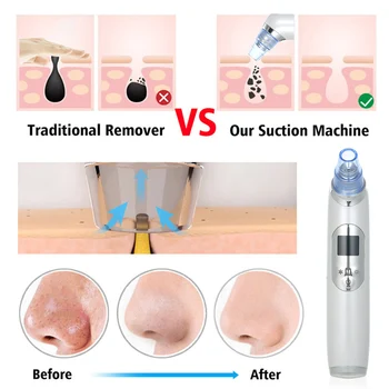 Professional Electric Blackhead Remover Pore Vacuum Cleaner Blackhead Extractor Tool Device with 5PCs Acne Removing Tools
Professional Electric Blackhead Remover Pore Vacuum Cleaner Blackhead Extractor Tool Device with 5PCs Acne Removing Tools