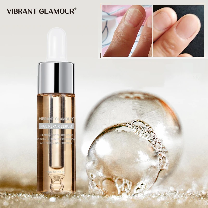 VIBRANTGLAMOUR Fungal Nail Treatment Feet Care Serum Nail Foot Nail Fungus Removal Gel Anti Infection Paronychia Onychomycosis
VIBRANTGLAMOUR Fungal Nail Treatment Feet Care Serum Nail Foot Nail Fungus Removal Gel Anti Infection Paronychia Onychomycosis