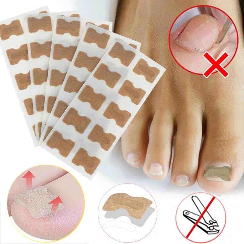 5pcs Non-Glue Ingrown Toenail Patch Set Correction Pedicure Tools for Toe Inlay Nail Corrector Patches Stickers Foot Care
5pcs Non-Glue Ingrown Toenail Patch Set Correction Pedicure Tools for Toe Inlay Nail Corrector Patches Stickers Foot Care