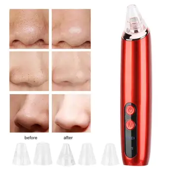 Electric Blackhead Removal Machine Pimple Remover Tool Face Pore Export Cleaning Machine For Face Cleaning Blackhead Removal
Electric Blackhead Removal Machine Pimple Remover Tool Face Pore Export Cleaning Machine For Face Cleaning Blackhead Removal
