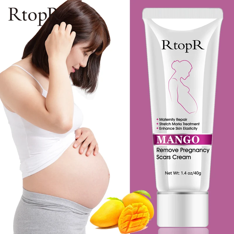 Mango Remove Pregnancy Scars Cream Repair Maternity Stretch Marks Obesity Lines Body Cream Anti-Winkles Firming Skin Care
Mango Remove Pregnancy Scars Cream Repair Maternity Stretch Marks Obesity Lines Body Cream Anti-Winkles Firming Skin Care