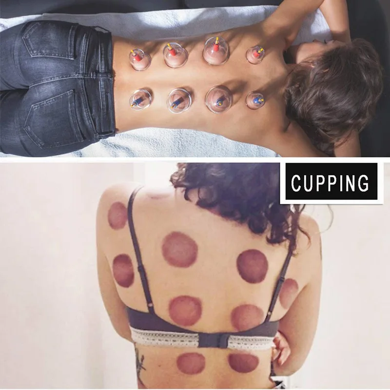 24Pcs Cupping Sets | Cupping Vacuum Suction 24 Cups Sets for Cellulite Cupping Massage Back | Chinese Cupping Pump 24Pcs Cupping Sets | Cupping Vacuum Suction 24 Cups Sets for Cellulite Cupping Massage Back | Chinese Cupping Pump