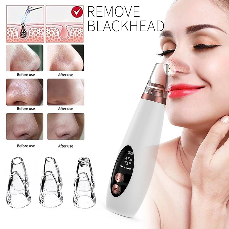 Best Blackhead Remover Vacuum 2021 Pore Cleaner Face Skin Care Best Blackhead Remover Vacuum 2021 Pore Cleaner Face Skin Care