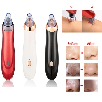 blackhead remover Skin Care Device Machine Set Pore Vacuum Acne Pimple Removal Cleaner 3 Modes Vacuum Suction Tool Face Clean
blackhead remover Skin Care Device Machine Set Pore Vacuum Acne Pimple Removal Cleaner 3 Modes Vacuum Suction Tool Face Clean