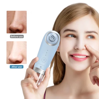 Blackhead Removal Vacuum Small Bubble Cleaner With Water Cycle Clean Shrink Pores Electric Deep Pore Cleaning Blackhead Remover
Blackhead Removal Vacuum Small Bubble Cleaner With Water Cycle Clean Shrink Pores Electric Deep Pore Cleaning Blackhead Remover