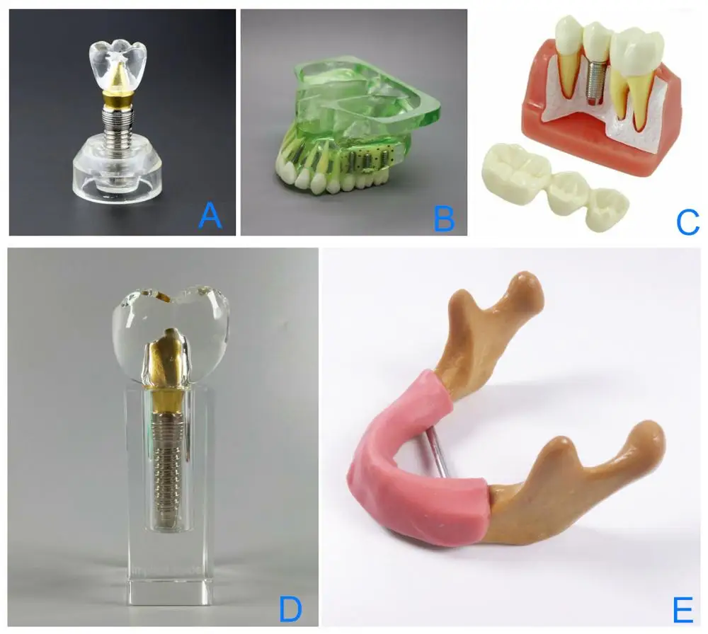 1 Piece Dental Teaching Model Implants Crown Abutment Bond Handpiece Dentist Study Models School
1 Piece Dental Teaching Model Implants Crown Abutment Bond Handpiece Dentist Study Models School