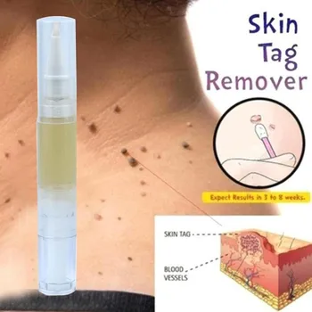 5ml Skin Tag Remover Medical Painless Fast Removal Mole Genital Wart Foot Corn Treatment Kit skin Care Anti Wart Bacteriostatic
5ml Skin Tag Remover Medical Painless Fast Removal Mole Genital Wart Foot Corn Treatment Kit skin Care Anti Wart Bacteriostatic