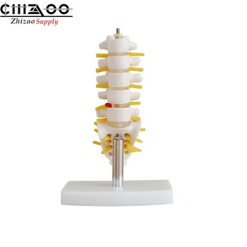 Mini Lumbar Vertebrae with Sacrum & Coccyx and Herniated Disc Anatomical Model
Mini Lumbar Vertebrae with Sacrum & Coccyx and Herniated Disc Anatomical Model