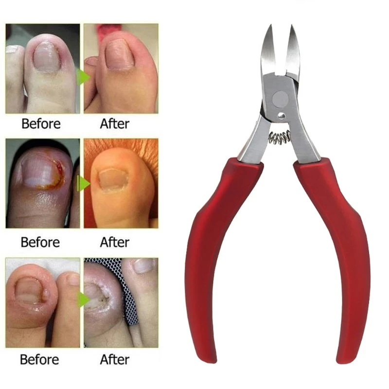 Nail Clippers Toenail Cutters Pedicure Manicure Tools Anti-Splash Ingrown Paronychia Professional Correction Tool
Nail Clippers Toenail Cutters Pedicure Manicure Tools Anti-Splash Ingrown Paronychia Professional Correction Tool