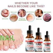 30ml Fungal Nail Treatment Pen To Remove Onychomycosis Tool Liquid Fungal Healthy Nail Care Paronychia Anti Polish F7K0 
30ml Fungal Nail Treatment Pen To Remove Onychomycosis Tool Liquid Fungal Healthy Nail Care Paronychia Anti Polish F7K0