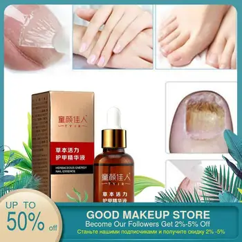 1PCS Fungal Nail Treatment Nail and Foot Whitening Toe Nail Fungus Removal Feet Care Nail
1PCS Fungal Nail Treatment Nail and Foot Whitening Toe Nail Fungus Removal Feet Care Nail