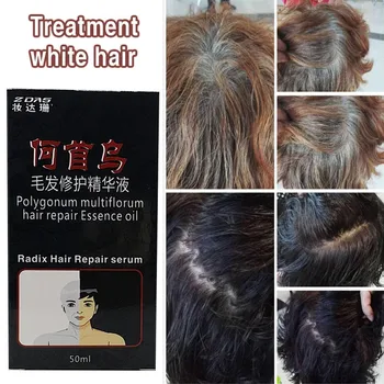 2bottle traditional Chinese medicine cure white hair turn gray black liquid juvenile loss care oil serum Treatment Conditioners 
2bottle traditional Chinese medicine cure white hair turn gray black liquid juvenile loss care oil serum Treatment Conditioners