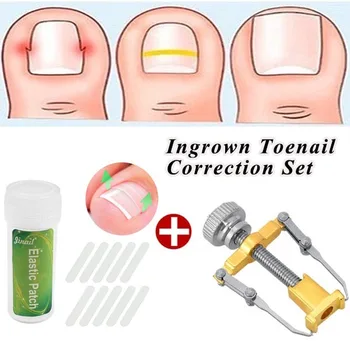 1PC Stainless Steel Ingrown Toe Nail Correction Tool +10Pcs Nail Correction Patch Nails Art Equipment Tool
1PC Stainless Steel Ingrown Toe Nail Correction Tool +10Pcs Nail Correction Patch Nails Art Equipment Tool