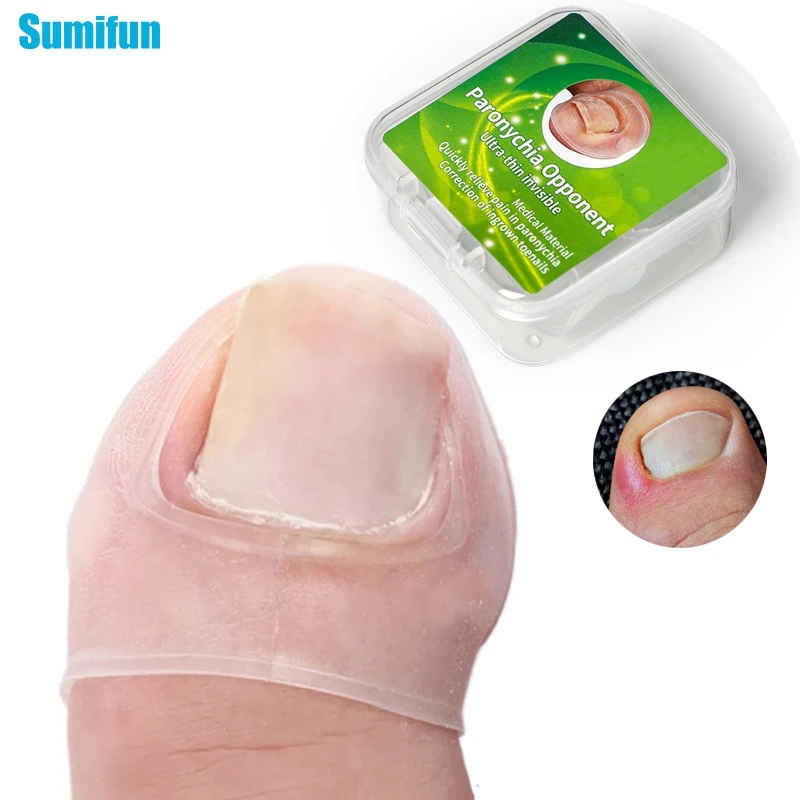2pcs/Box Silicone Ingrown Toe Nail Correction Wire Fixer Pedicure Paronychia Recover Toenails Corrector Nail Correction Tool
2pcs/Box Silicone Ingrown Toe Nail Correction Wire Fixer Pedicure Paronychia Recover Toenails Corrector Nail Correction Tool