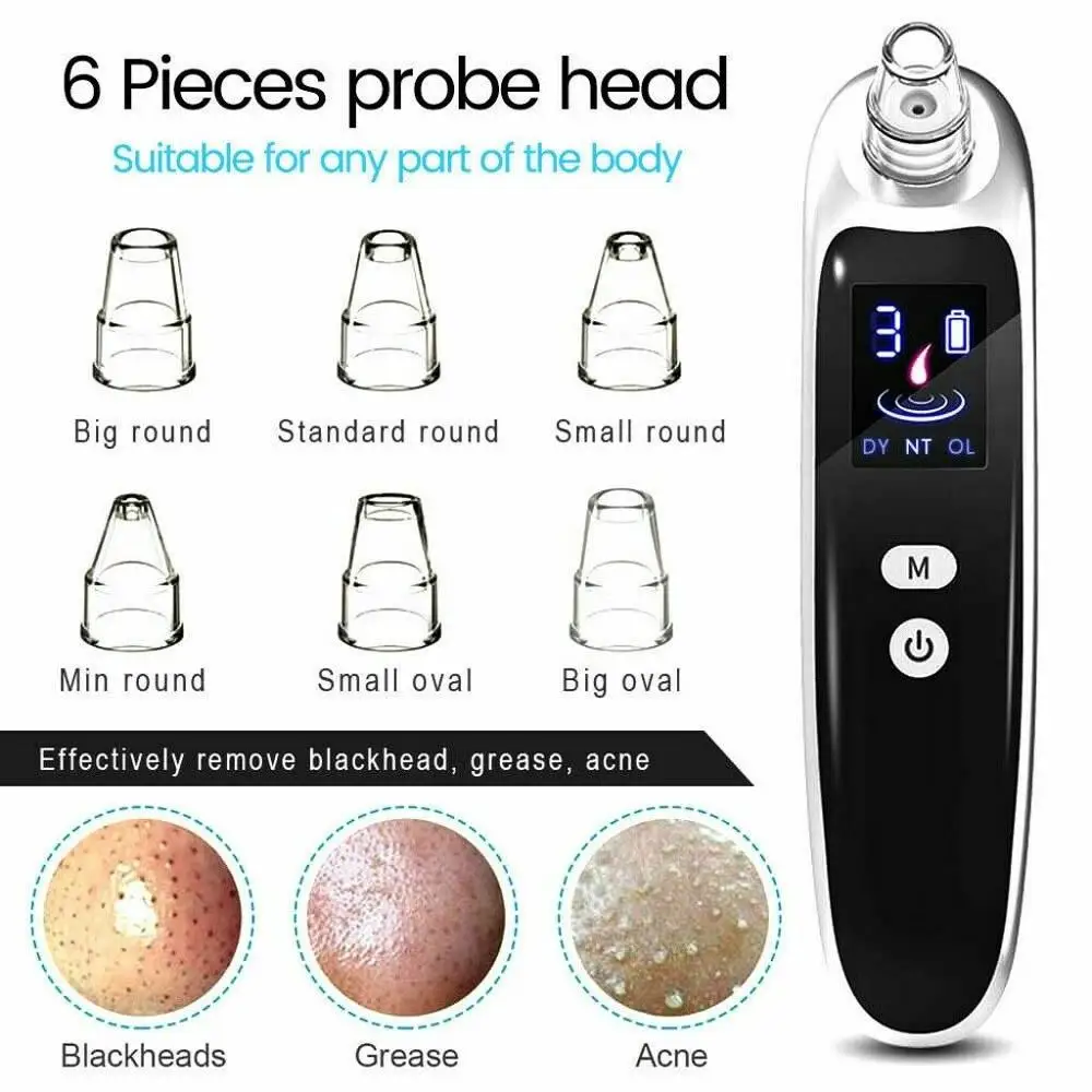 Remove Blackheads Acne Cleansing Electronic Beauty Instrument Deep Addition To Blackheads Acne Does Not Hurt Skin Beauty Tools
Remove Blackheads Acne Cleansing Electronic Beauty Instrument Deep Addition To Blackheads Acne Does Not Hurt Skin Beauty Tools