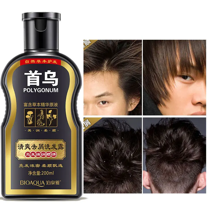 Polygonum Multiflorum Anti-dandruff Shampoo Anti-Dandruff Anti Hair Loss Moisturizing Refreshing Oil Control Black Hair Care
Polygonum Multiflorum Anti-dandruff Shampoo Anti-Dandruff Anti Hair Loss Moisturizing Refreshing Oil Control Black Hair Care