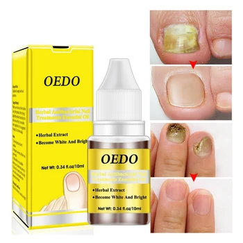 Oedo herbal Antibacterial Nail Treatments Essential Oil Herbal Extract Nail Fungus Art Repair Tools Foot Nail Care Improve Infec
Oedo herbal Antibacterial Nail Treatments Essential Oil Herbal Extract Nail Fungus Art Repair Tools Foot Nail Care Improve Infec