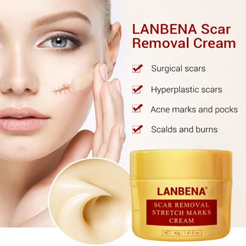LANBENA Scar Removal Cream Stretch Marks Removal Cream For Men and Women Face Cream To Repair Cream Burns And Removes Scars
LANBENA Scar Removal Cream Stretch Marks Removal Cream For Men and Women Face Cream To Repair Cream Burns And Removes Scars