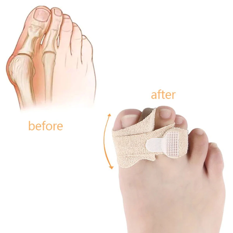 Care Gel Bunion Protector Toe Separators Straightener Correctors 2Pcs/set Hallux Valgus Correction Silicone Bandage Foot
Care Gel Bunion Protector Toe Separators Straightener Correctors 2Pcs/set Hallux Valgus Correction Silicone Bandage Foot