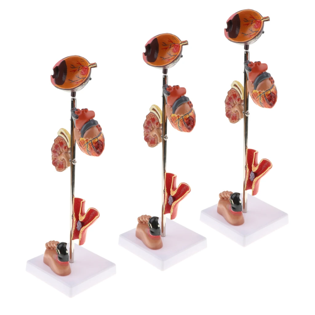 3 Pieces Scientific Pathological Diabetes Model, 5 Part Anatomy Medical Model for Lab Equipment Demonstration Tools
3 Pieces Scientific Pathological Diabetes Model, 5 Part Anatomy Medical Model for Lab Equipment Demonstration Tools