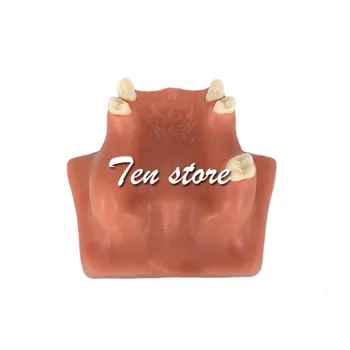Resin Teeth Jaw Teeth Model Maxillary Breast Implant Dental Restoration Teach Study Practice Model For Doctor Demostration
Resin Teeth Jaw Teeth Model Maxillary Breast Implant Dental Restoration Teach Study Practice Model For Doctor Demostration