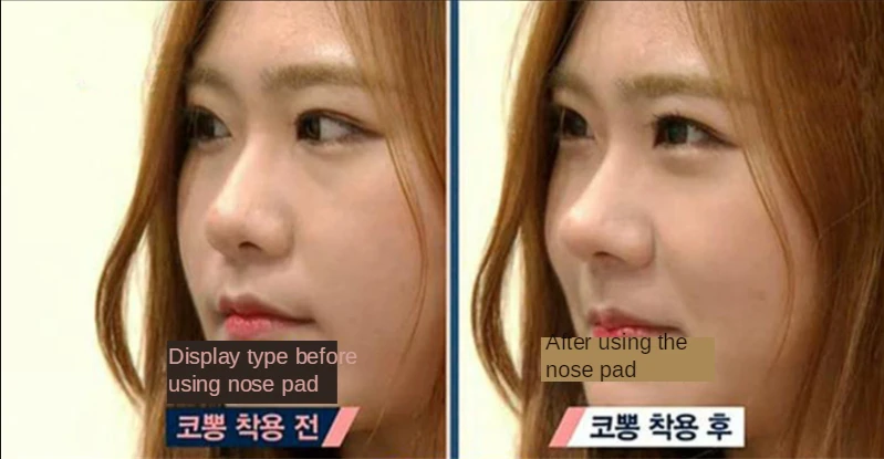 3D nose straightener19