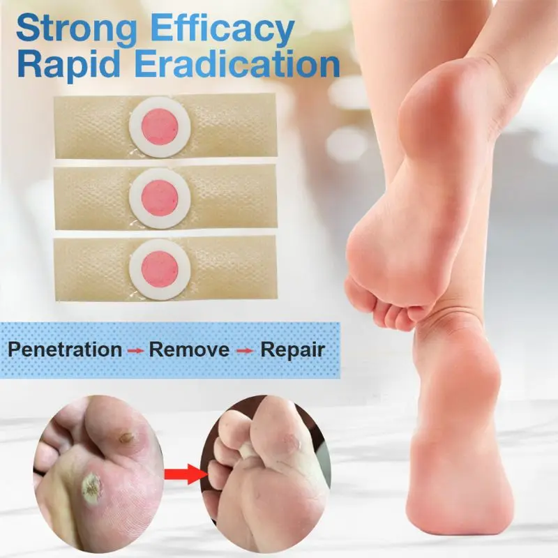 24Pcs/Box Medical Plaster Foot Corn Callus Removal Thorn Plantar Warts Plaster Dressing Pain Relief Patch Health Care
24Pcs/Box Medical Plaster Foot Corn Callus Removal Thorn Plantar Warts Plaster Dressing Pain Relief Patch Health Care