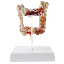 Human Large Intestin Pathological Model, Medical Teaching Model, 1/2 Mini Sized, on Stand
Human Large Intestin Pathological Model, Medical Teaching Model, 1/2 Mini Sized, on Stand