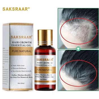 Hair Care Hair Growth Essential Oils Essence Grow Hair Fluid Prevent Hair Loss Health Care Beauty Dense Hair Growth Serum
Hair Care Hair Growth Essential Oils Essence Grow Hair Fluid Prevent Hair Loss Health Care Beauty Dense Hair Growth Serum
