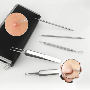 6Pcs/Set Acne Blackhead Remover Needles to Remove Blackheads, Acne Black Spot Extractor Stainless Steel Pimple Removal Tool
6Pcs/Set Acne Blackhead Remover Needles to Remove Blackheads, Acne Black Spot Extractor Stainless Steel Pimple Removal Tool