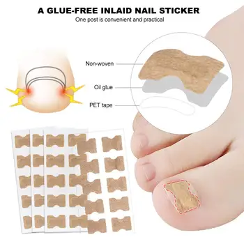 10/100PCS Nail Art Ingrown Correction Sticker Foot Care Pedicure Tool Fixer Paronychia Recover Toenail Elastic Patch Corrector
10/100PCS Nail Art Ingrown Correction Sticker Foot Care Pedicure Tool Fixer Paronychia Recover Toenail Elastic Patch Corrector