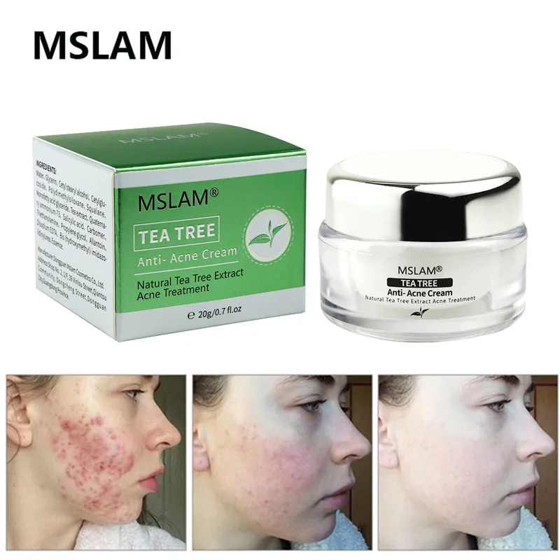 MSLAM Acne Treatment Cream Tea Tree Acne Removal Anti Acne Cream Oil Control Shrink Pores Acne Scar Repair Face Skin Care
MSLAM Acne Treatment Cream Tea Tree Acne Removal Anti Acne Cream Oil Control Shrink Pores Acne Scar Repair Face Skin Care