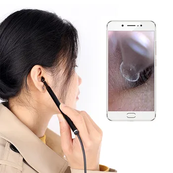 3 In 1 Ear Otoscope Medical Professional HD Camera Household Nose Ear Endoscope Led Adjustable Ear Spoon for Child Adult M Dical
3 In 1 Ear Otoscope Medical Professional HD Camera Household Nose Ear Endoscope Led Adjustable Ear Spoon for Child Adult M Dical