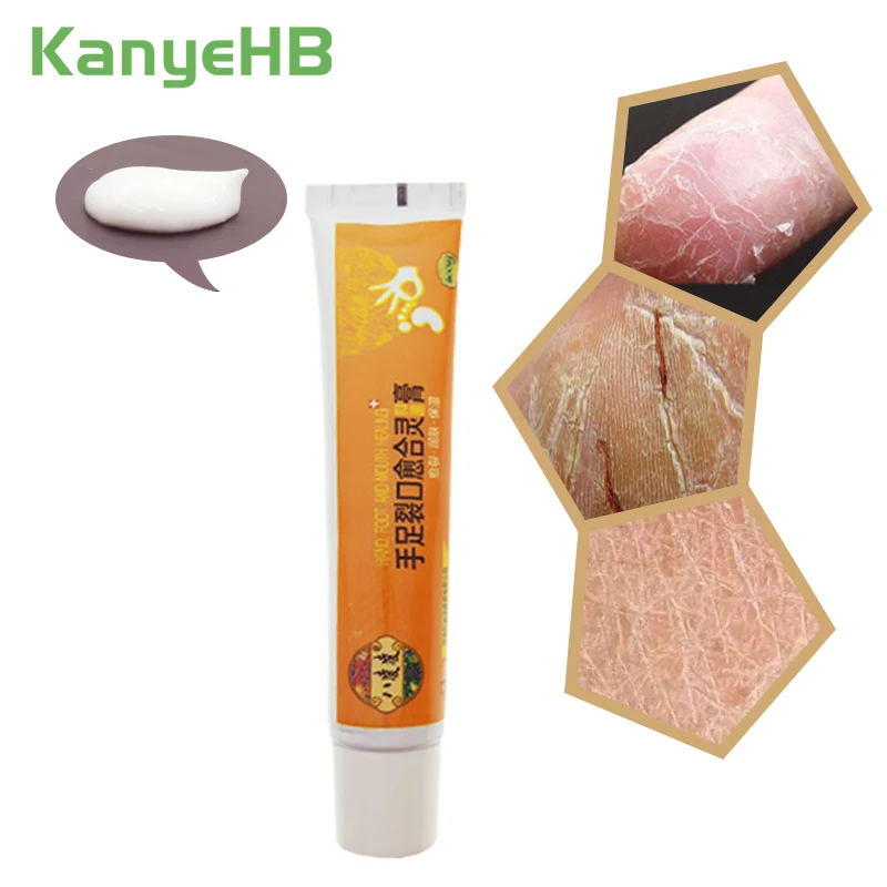1Pcs Natural Ointment Oil Anti-Drying Crack Foot Cream Powerful Heel Cracked Repair Cream Removal Dead Skin Hand Feet Care S012
1Pcs Natural Ointment Oil Anti-Drying Crack Foot Cream Powerful Heel Cracked Repair Cream Removal Dead Skin Hand Feet Care S012