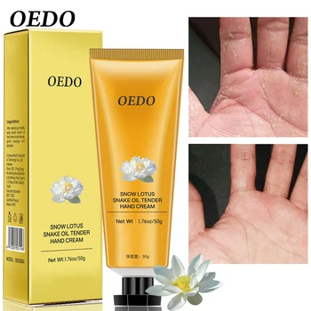 Snow Lotus Snake Oil Moisturizing Renewal Hand Cream Moisturizing Anti-Wrinkle Whitening Skin Sunscreen Hand Skin Care Products
Snow Lotus Snake Oil Moisturizing Renewal Hand Cream Moisturizing Anti-Wrinkle Whitening Skin Sunscreen Hand Skin Care Products