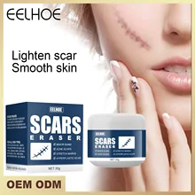 EELHOE Scar Removal Cream Acne Scars Gel Stretch Marks Surgical Scar Burn For Body Pigmentation Corrector Acne Spots Repair Care
EELHOE Scar Removal Cream Acne Scars Gel Stretch Marks Surgical Scar Burn For Body Pigmentation Corrector Acne Spots Repair Care