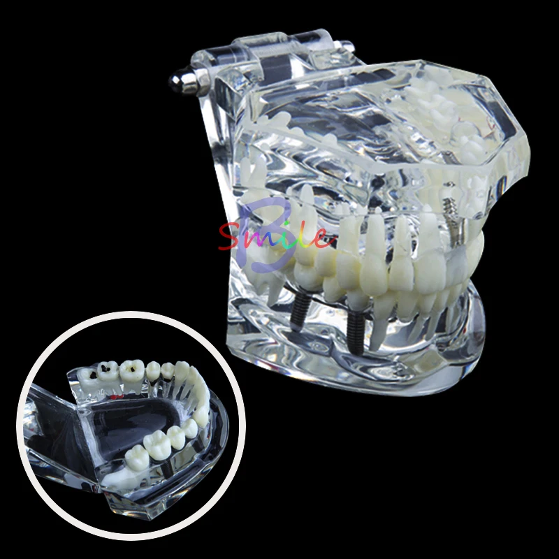 1pcs new Dental Study Tooth Transparent Adult Pathological Teeth Model Dental Lab Equipment DentistTeaching instrument tool
1pcs new Dental Study Tooth Transparent Adult Pathological Teeth Model Dental Lab Equipment DentistTeaching instrument tool