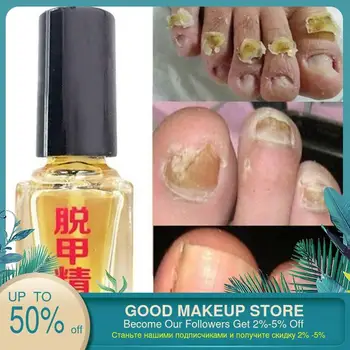 5ml Fungus Removal Liquid Fungal Nail Treatment Liquid Bright Nail Repair Anti Infection Foot Caring Onychomycosis
5ml Fungus Removal Liquid Fungal Nail Treatment Liquid Bright Nail Repair Anti Infection Foot Caring Onychomycosis