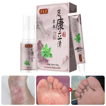 Foot Spray Ointment Set Herbal Essence Foot Care Disinfectant Ointment Remove Foot Sweat Odor Itchy SSwell
Foot Spray Ointment Set Herbal Essence Foot Care Disinfectant Ointment Remove Foot Sweat Odor Itchy SSwell