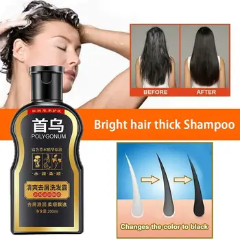 200ml Polygonum Multiflorum Anti-Dandruff Shampoo For Anti Hair Loss Moisturizing Refreshing Oil Control Black Hair Care
200ml Polygonum Multiflorum Anti-Dandruff Shampoo For Anti Hair Loss Moisturizing Refreshing Oil Control Black Hair Care