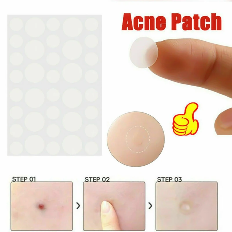 36pcs Remover Pimple Master Patch Acne Treatment Protects Invisible Acne Patch Face Care Cosmetics Face Skin Care Tools Dropship
36pcs Remover Pimple Master Patch Acne Treatment Protects Invisible Acne Patch Face Care Cosmetics Face Skin Care Tools Dropship