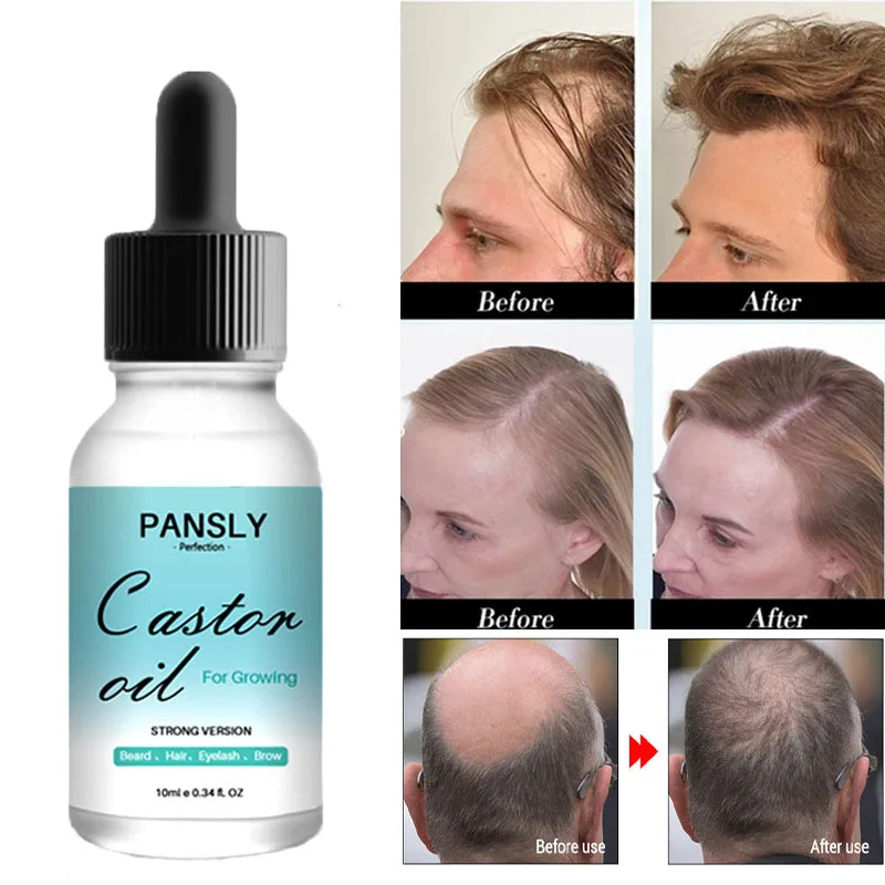 10ml Castor Oil Hair Growth Skin Massage Essential Oil Eyebrows Growth Prevent Skin Aging Castor Organic Extract
10ml Castor Oil Hair Growth Skin Massage Essential Oil Eyebrows Growth Prevent Skin Aging Castor Organic Extract