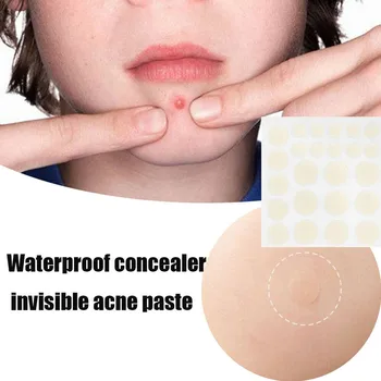48pcs Acne Pimple Patch Stickers Face Mask Skin Care Acne Treatment Serum Stickers Anti Acne Blackhead Pimple Treatment Stickers
48pcs Acne Pimple Patch Stickers Face Mask Skin Care Acne Treatment Serum Stickers Anti Acne Blackhead Pimple Treatment Stickers