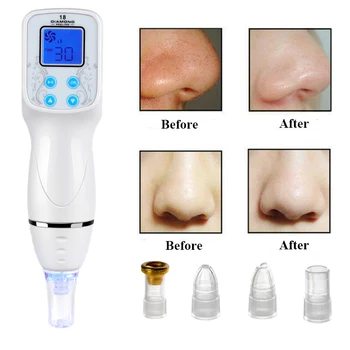 Blackhead Removal Vacuum Suction Diamond Microdermabrasion Skin Peeling Scar Acne Removal Diamond Dermabrasion Facial Massage 
Blackhead Removal Vacuum Suction Diamond Microdermabrasion Skin Peeling Scar Acne Removal Diamond Dermabrasion Facial Massage