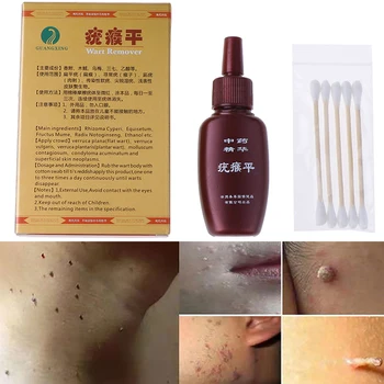 Skin Tag Remover 12 hours Tu kill Medical Tu kill Remover Skin Tag Mole & Genital Wart Remover Dropshipping
Skin Tag Remover 12 hours Tu kill Medical Tu kill Remover Skin Tag Mole & Genital Wart Remover Dropshipping
