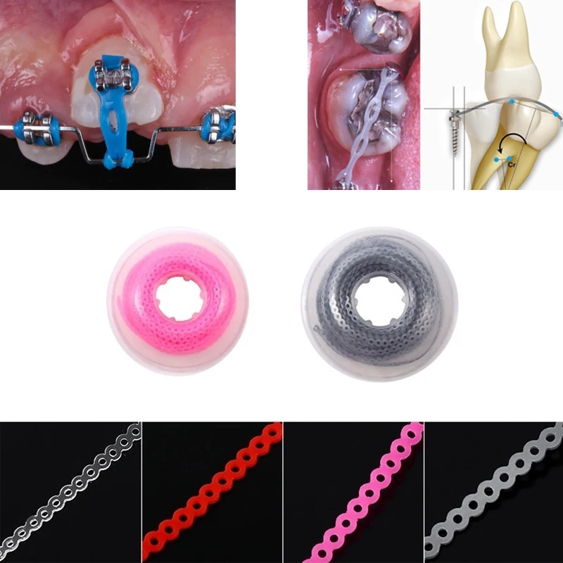 NSKLED New 1Roll Dental Orthodontic Elastic Ultra Power Chain Rubber Braces Bands Continuous /Short/Long Type 15 feet Colourful
NSKLED New 1Roll Dental Orthodontic Elastic Ultra Power Chain Rubber Braces Bands Continuous /Short/Long Type 15 feet Colourful